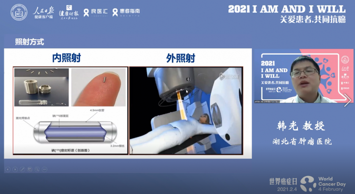 中方领衔团队破解辐射损伤细胞机制 有望优化放疗防护