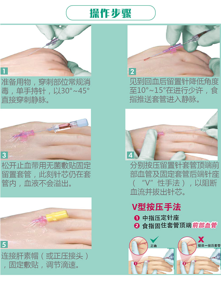 迈得医疗获得实用新型专利授权：“一种静脉针供料装置”