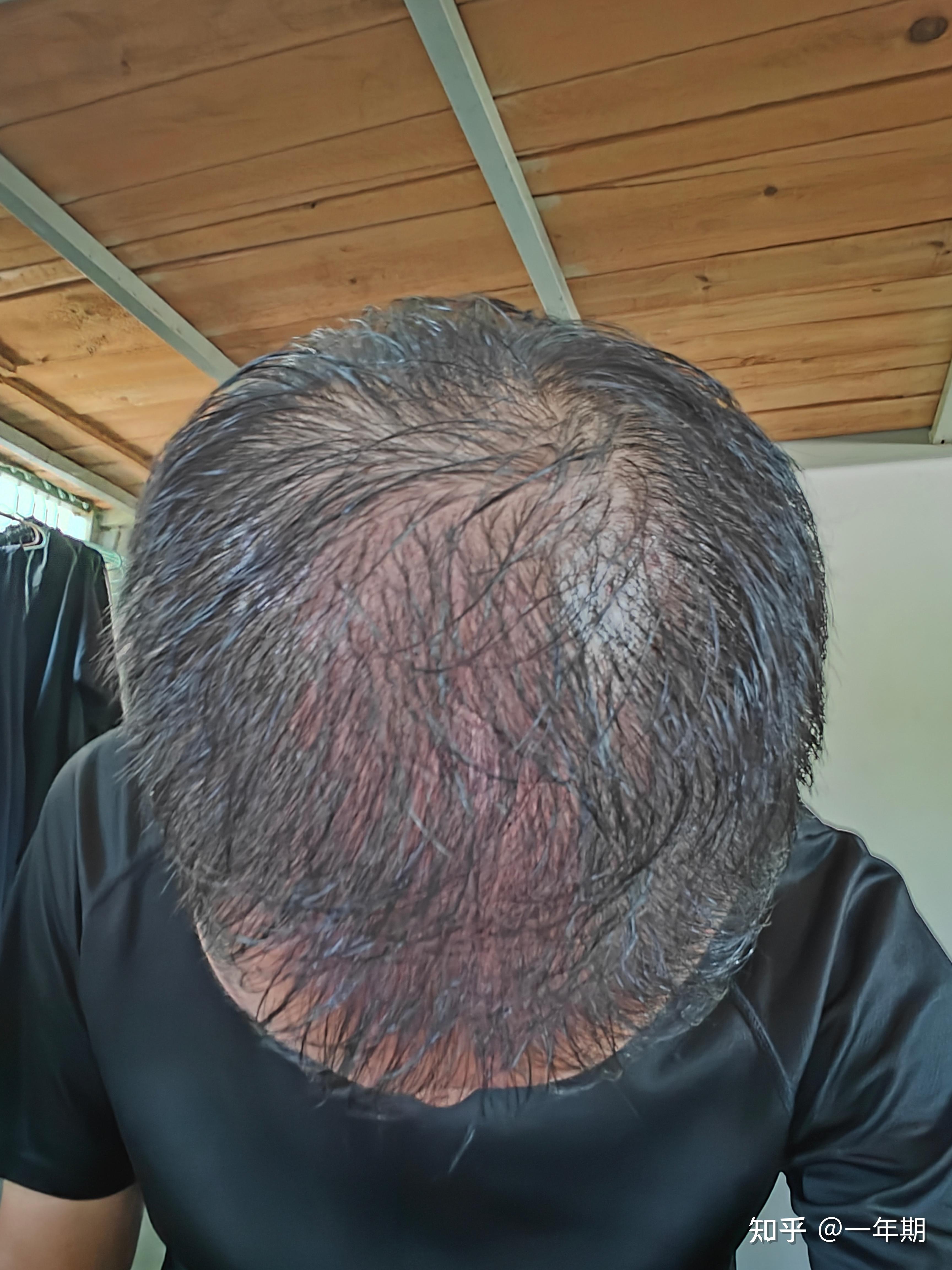 能特科技：天科制药的首款原料药――米诺地尔2024年5月底获取批文