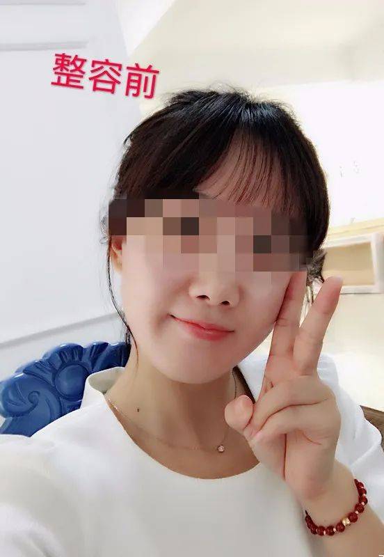 一针下去“美容”变“毁容” 记者调查医美注射乱象