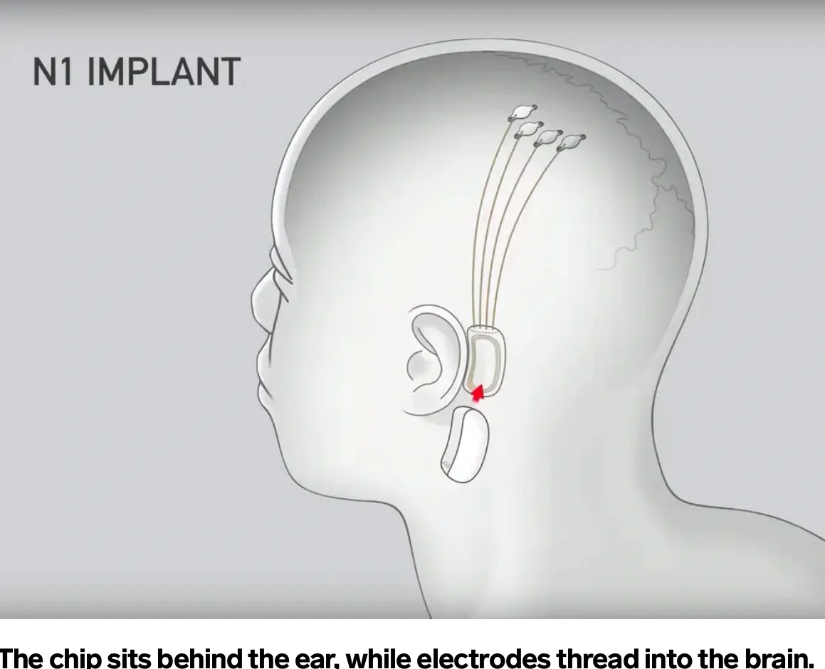 脑机接口，从“解码语言”到更多可能