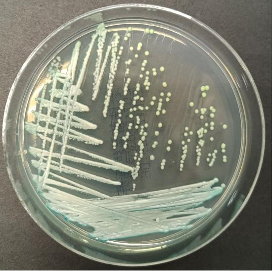 以色列科研人员“复活”80年前真菌标本