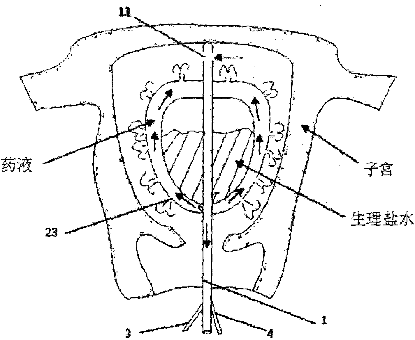 孚能科技获得实用新型专利授权：“运输线转弯装置”