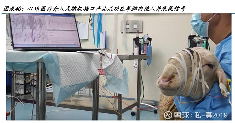 美好医疗：具备拓展脑机接口产品研发制造能力