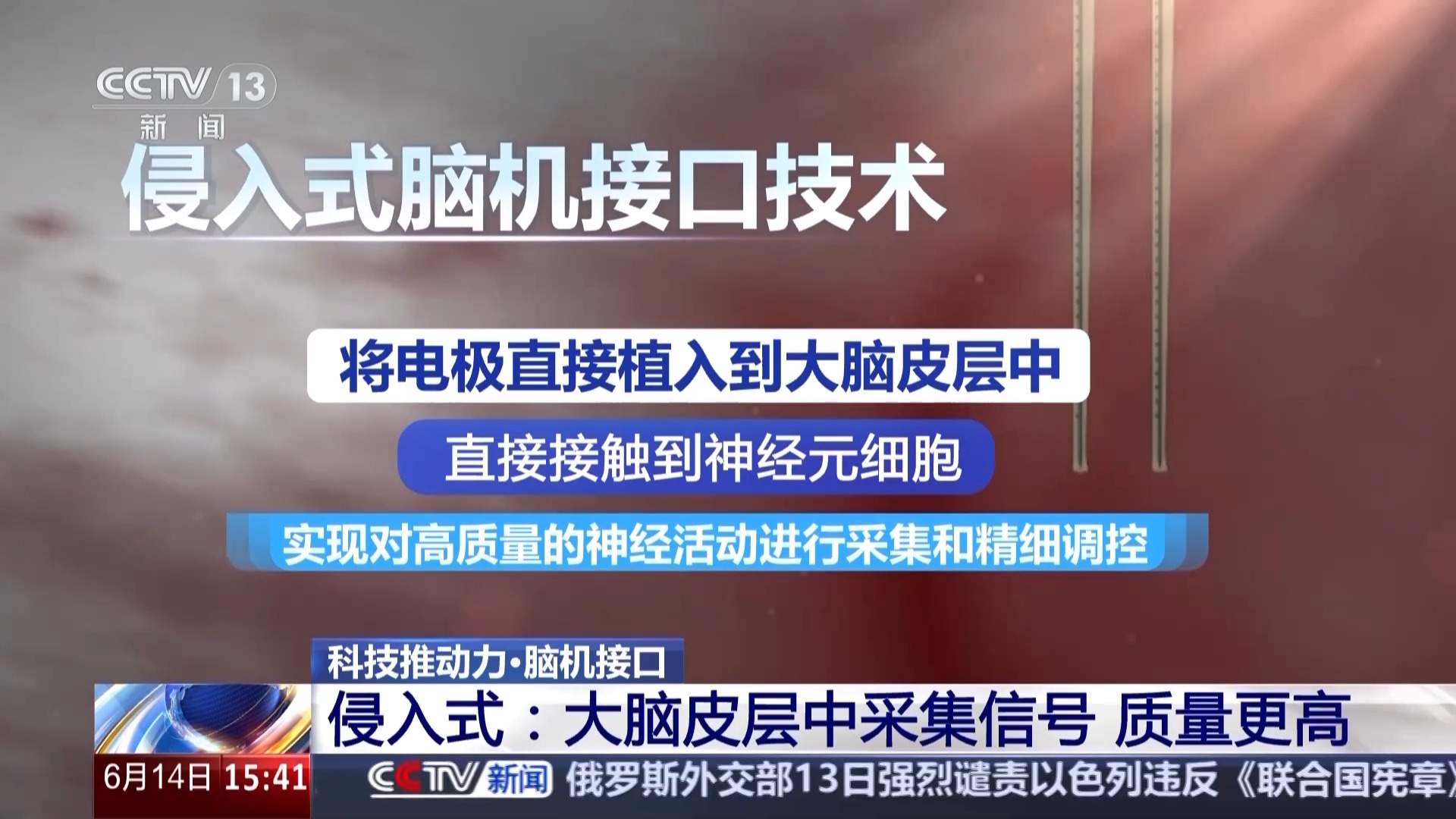 美好医疗：具备拓展脑机接口产品研发制造能力