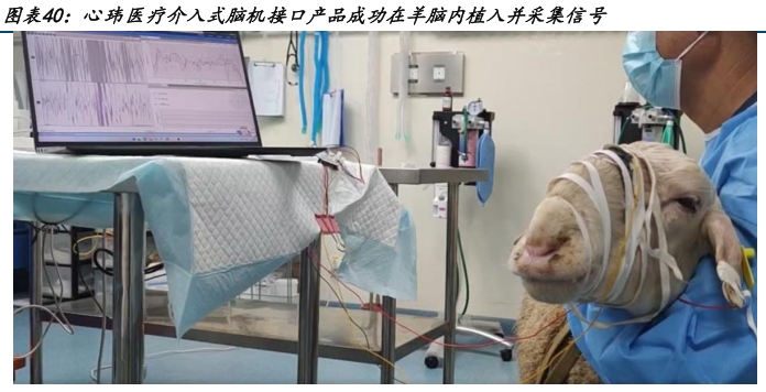 市场最前沿丨加速“接入”现实！脑机接口迈入产业化快车道