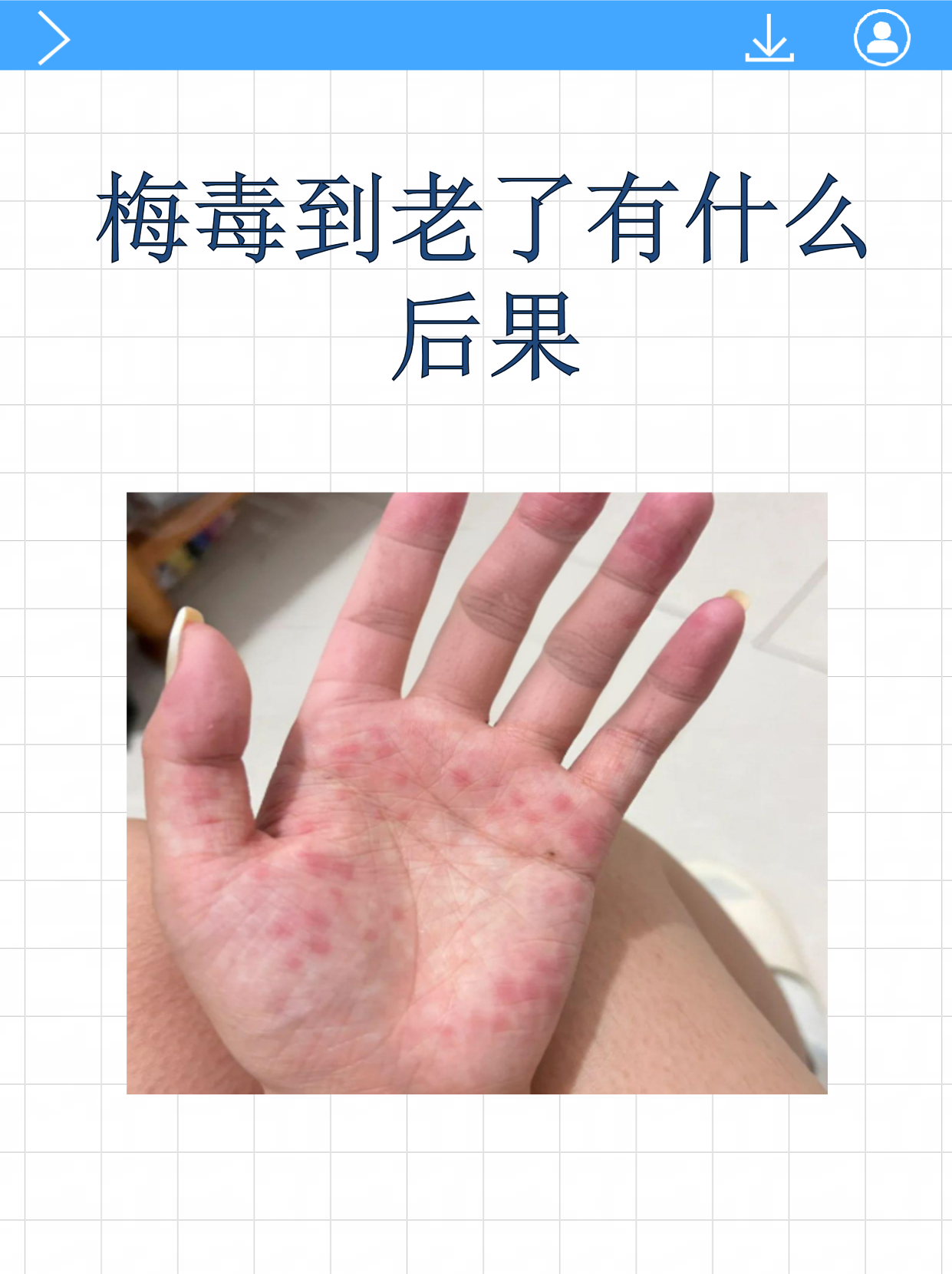 研究人员发现迄今最早梅毒螺旋体感染记录