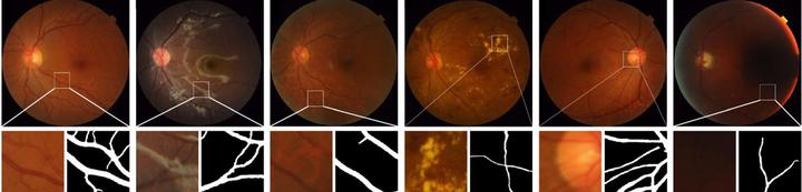 联影医疗获得发明专利授权：“血管图像处理方法、装置、计算机设备和存储介质”
