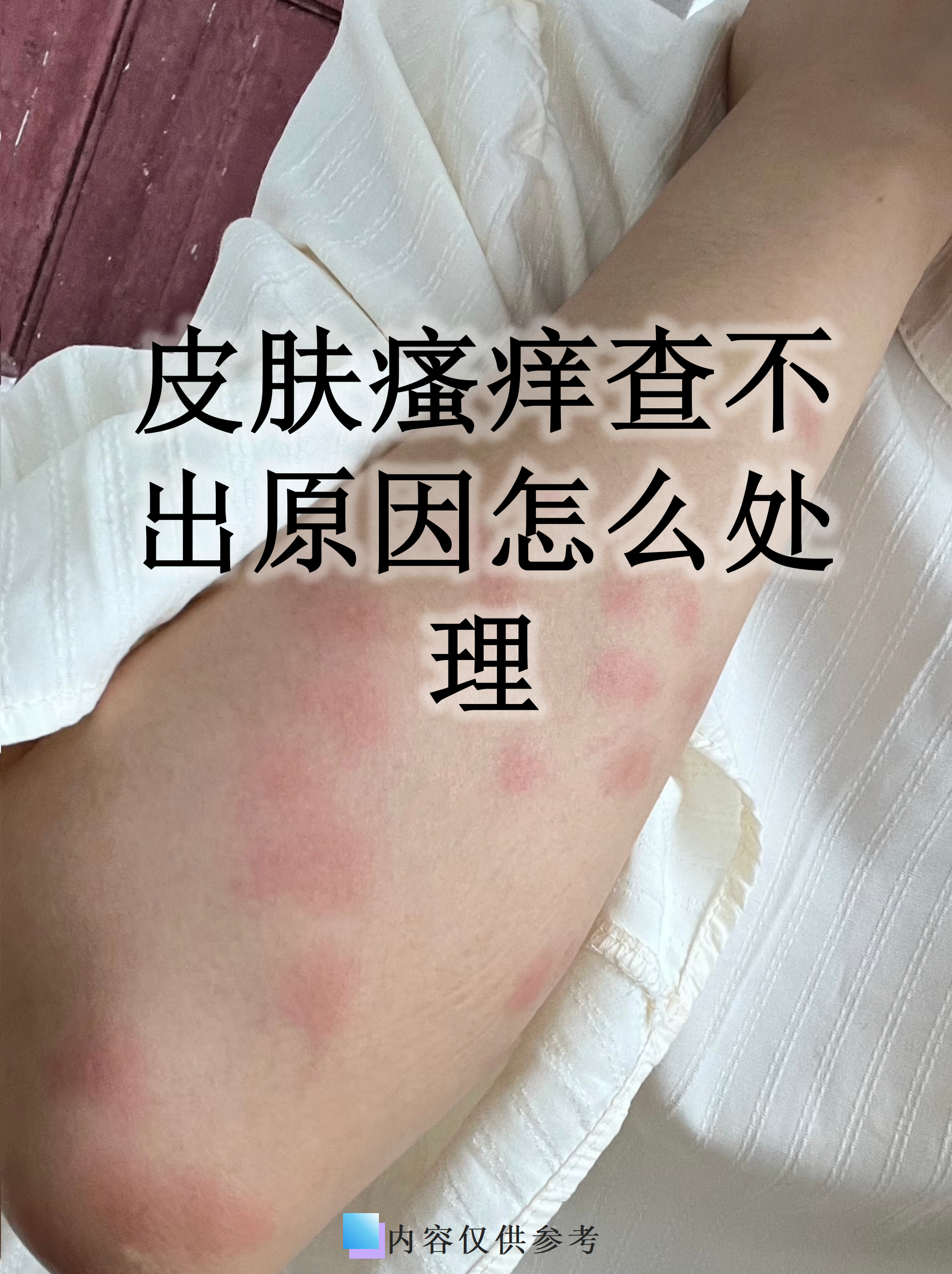 儿童过敏能“长大自愈”?医生提醒春季过敏防控别陷误区